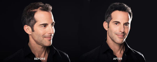 Toppik Hair Building Fibers 27.5 Gr- Light Brown